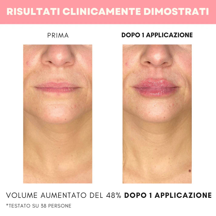 Dermalips™ - Trattamento Rimpolpante Labbra con Siero Coreano