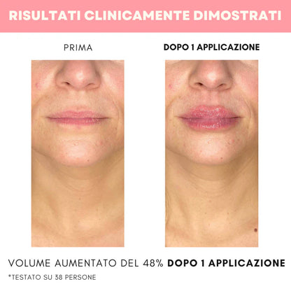 Dermalips™ - Trattamento Rimpolpante Labbra con Siero Coreano